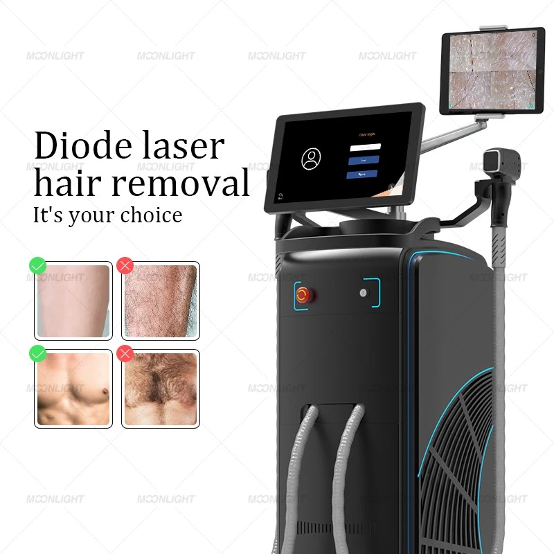 AI Laser Hair Removal Machine Manufacturer