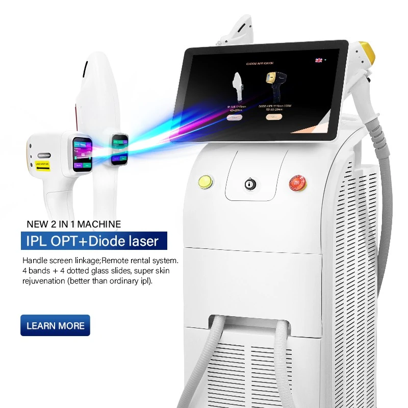Hospital Use Laser Hair Removal Machine – Professional-Grade Hair Removal And Skin Rejuvenation
