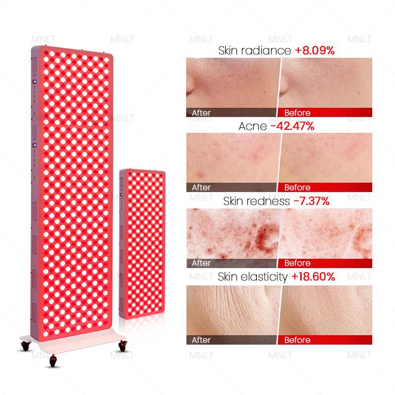 Red Light Beauty Equipment - Professional Anti -Aging & Pain Relief Therapy Panel